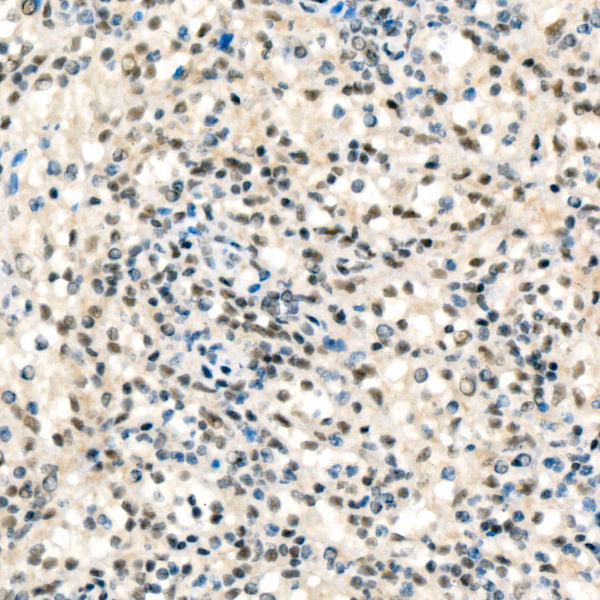 Fos B Rabbit mAb