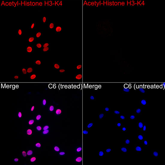 Acetyl-Histone H3-K4 Rabbit mAb