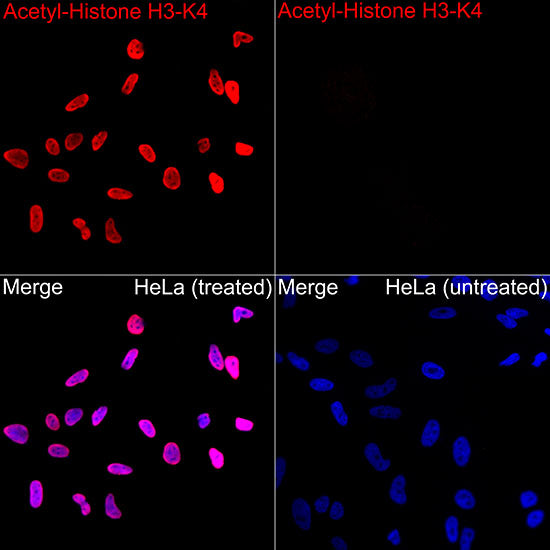 Acetyl-Histone H3-K4 Rabbit mAb