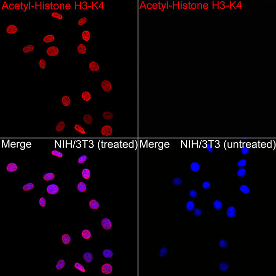 Acetyl-Histone H3-K4 Rabbit mAb