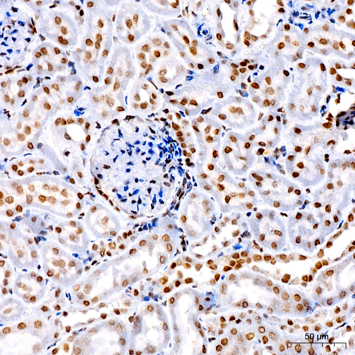 Acetyl-Histone H3-K4 Rabbit mAb