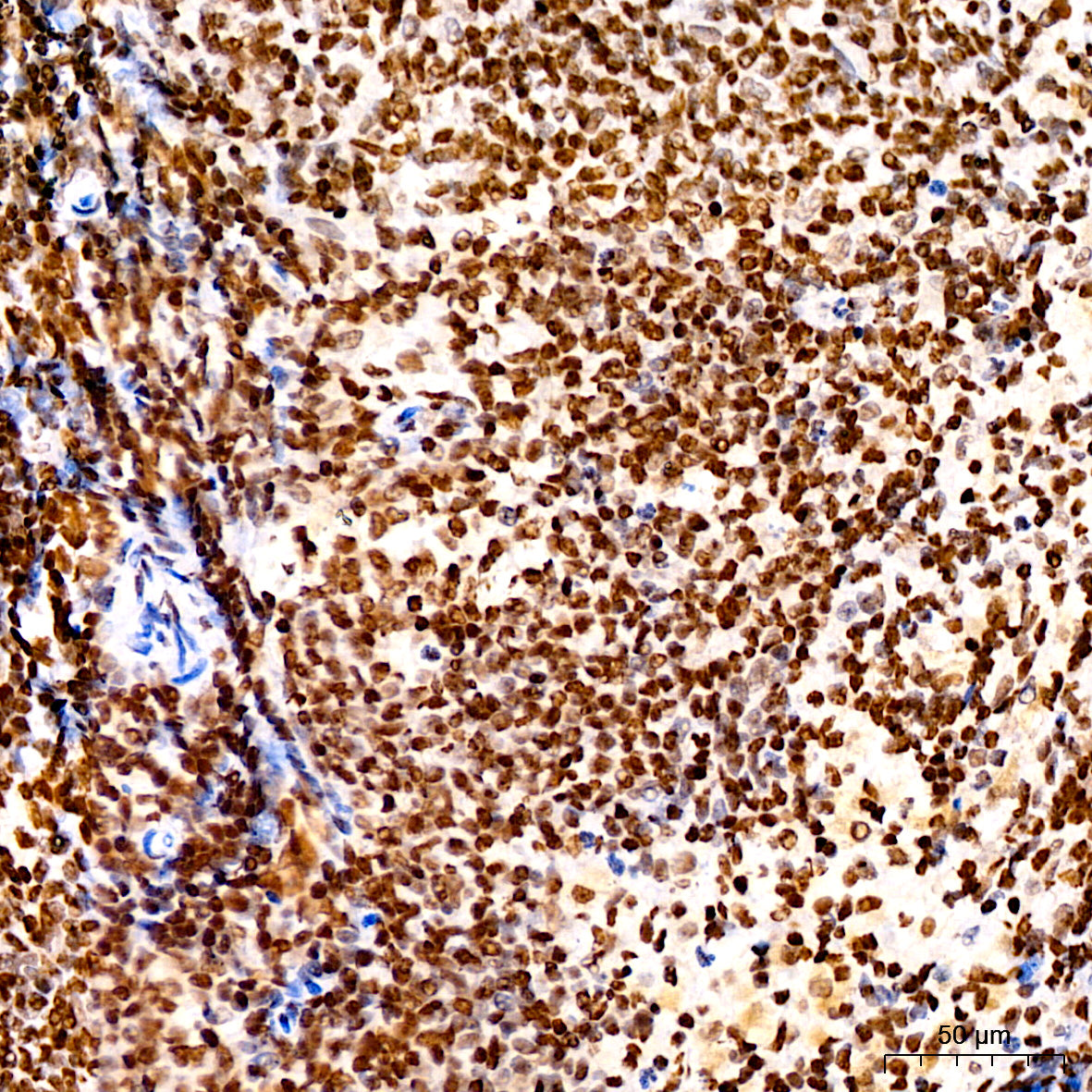 Acetyl-Histone H3-K4 Rabbit mAb
