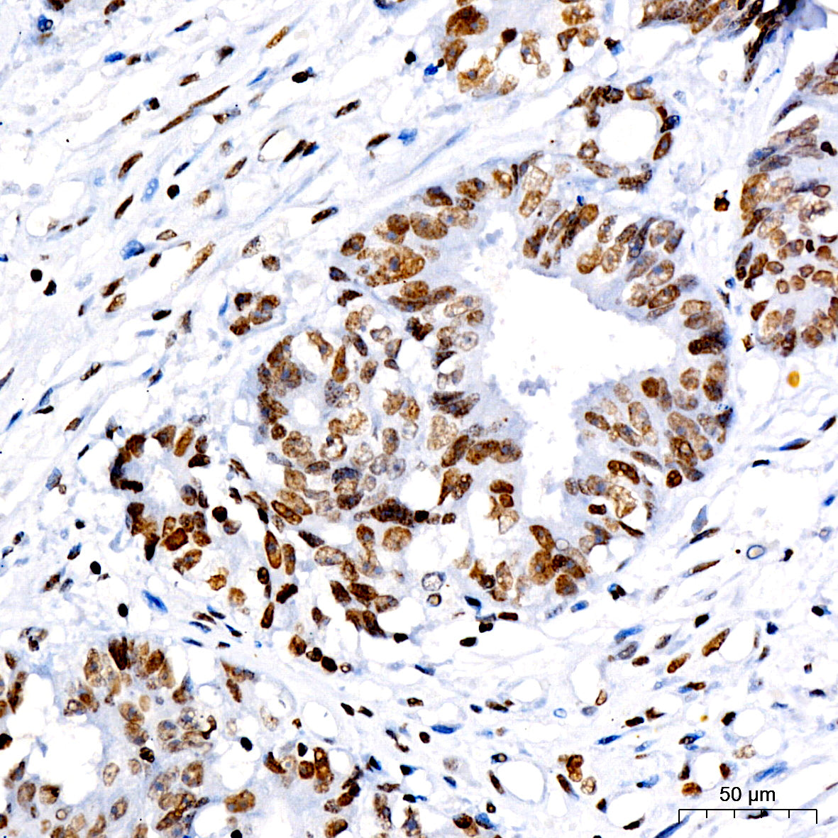 Acetyl-Histone H3-K4 Rabbit mAb