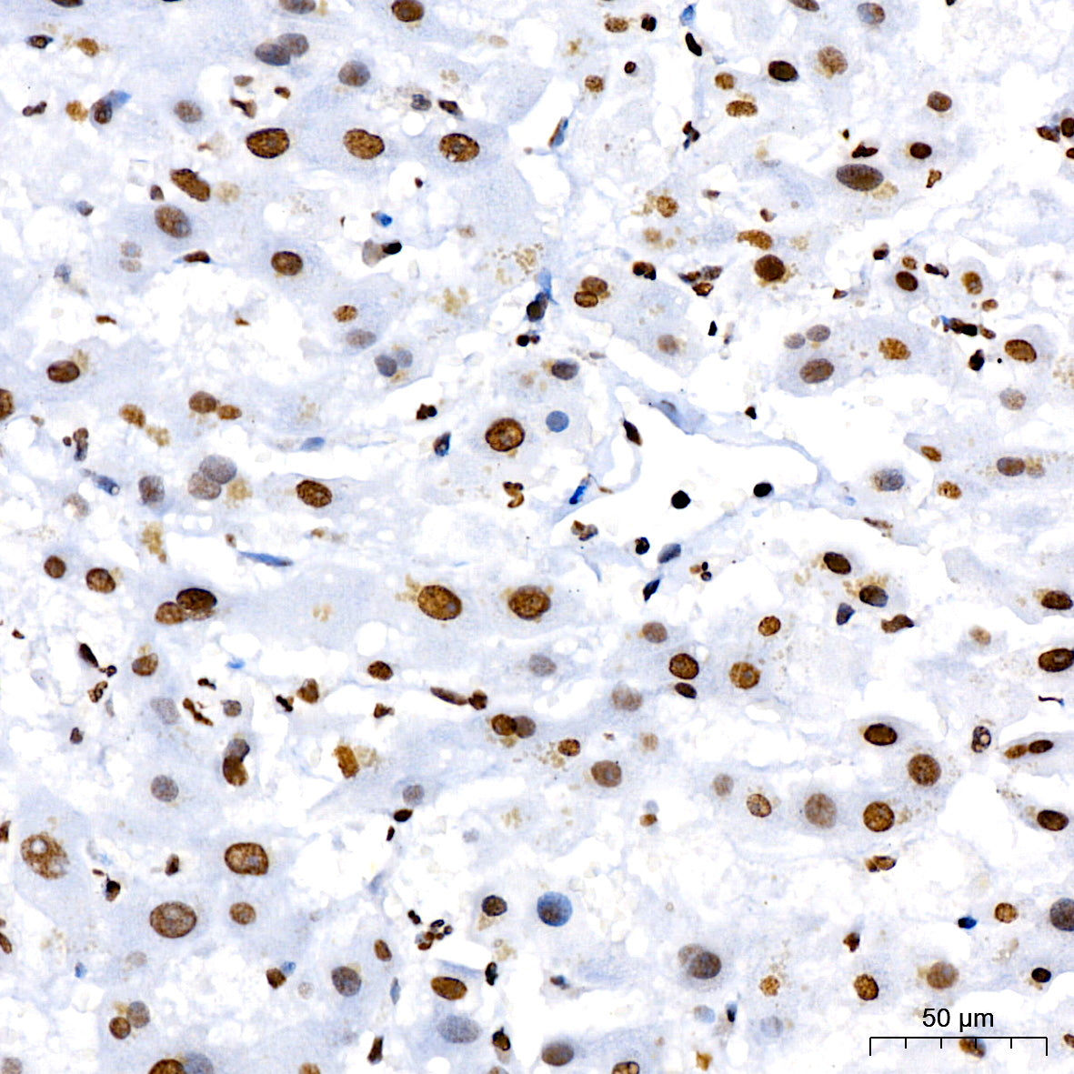 Acetyl-Histone H3-K4 Rabbit mAb