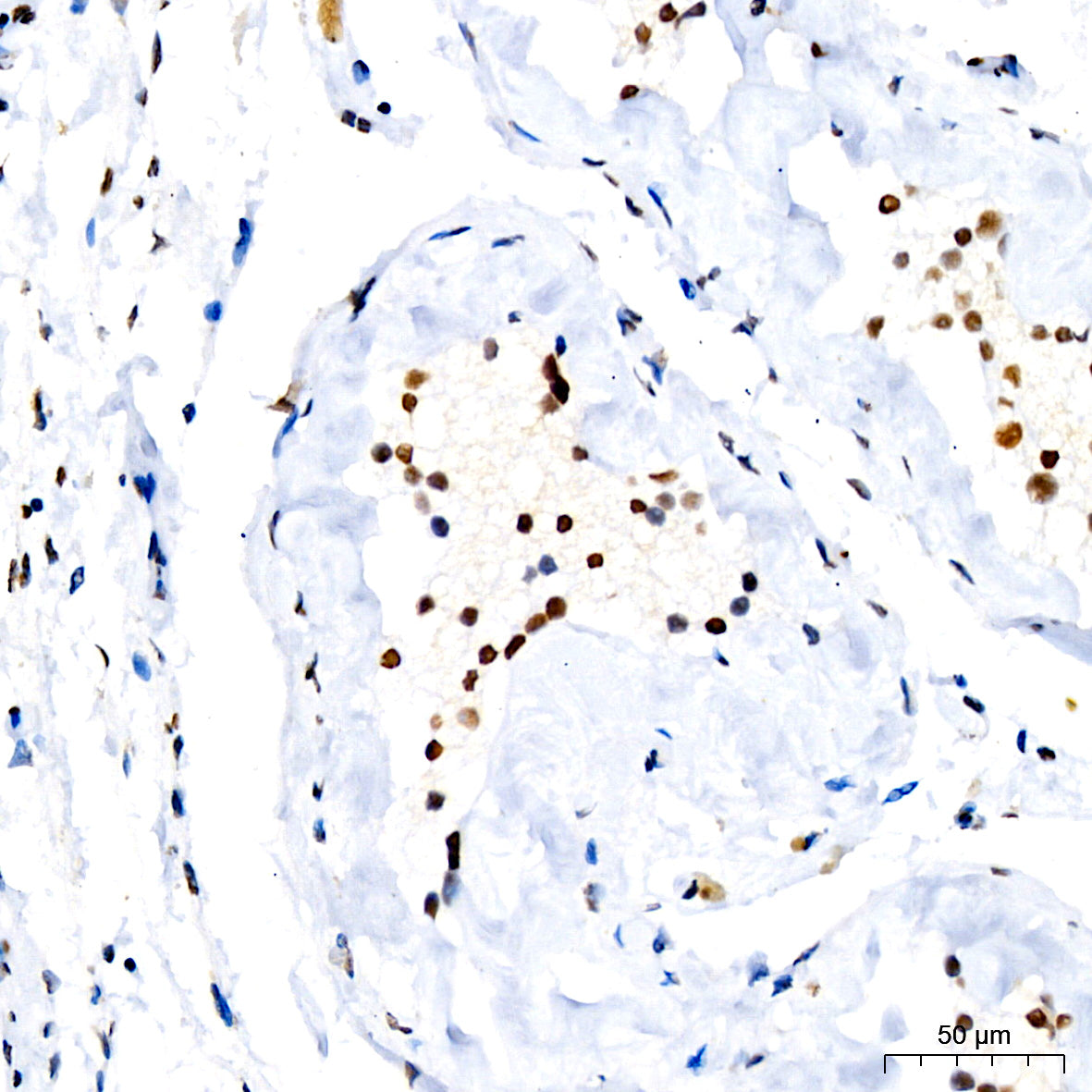 Acetyl-Histone H3-K4 Rabbit mAb