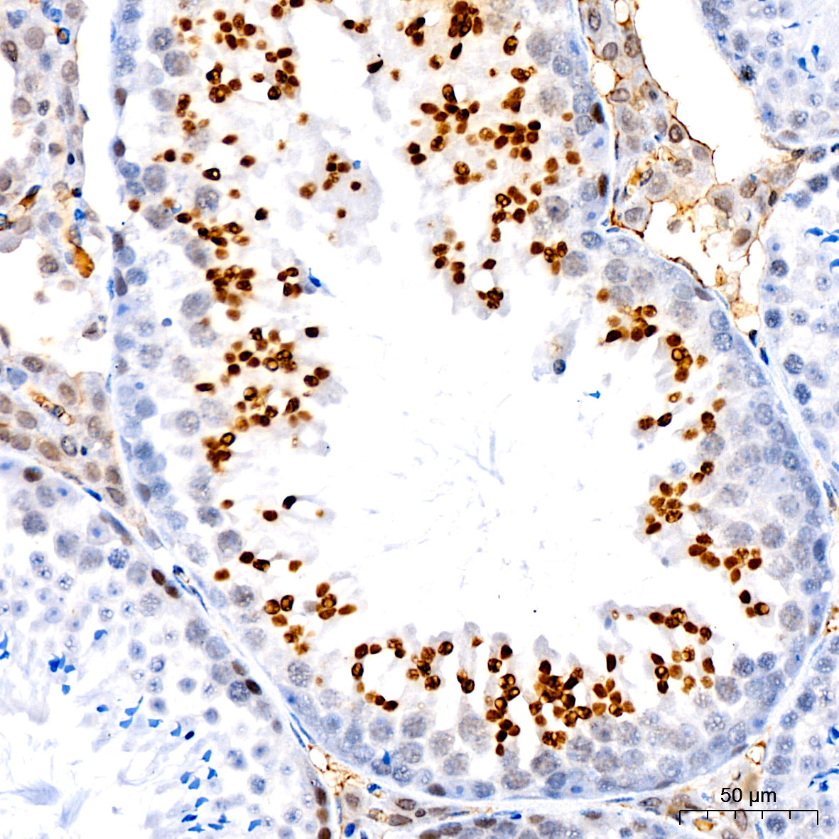 Acetyl-Histone H3-K4 Rabbit mAb