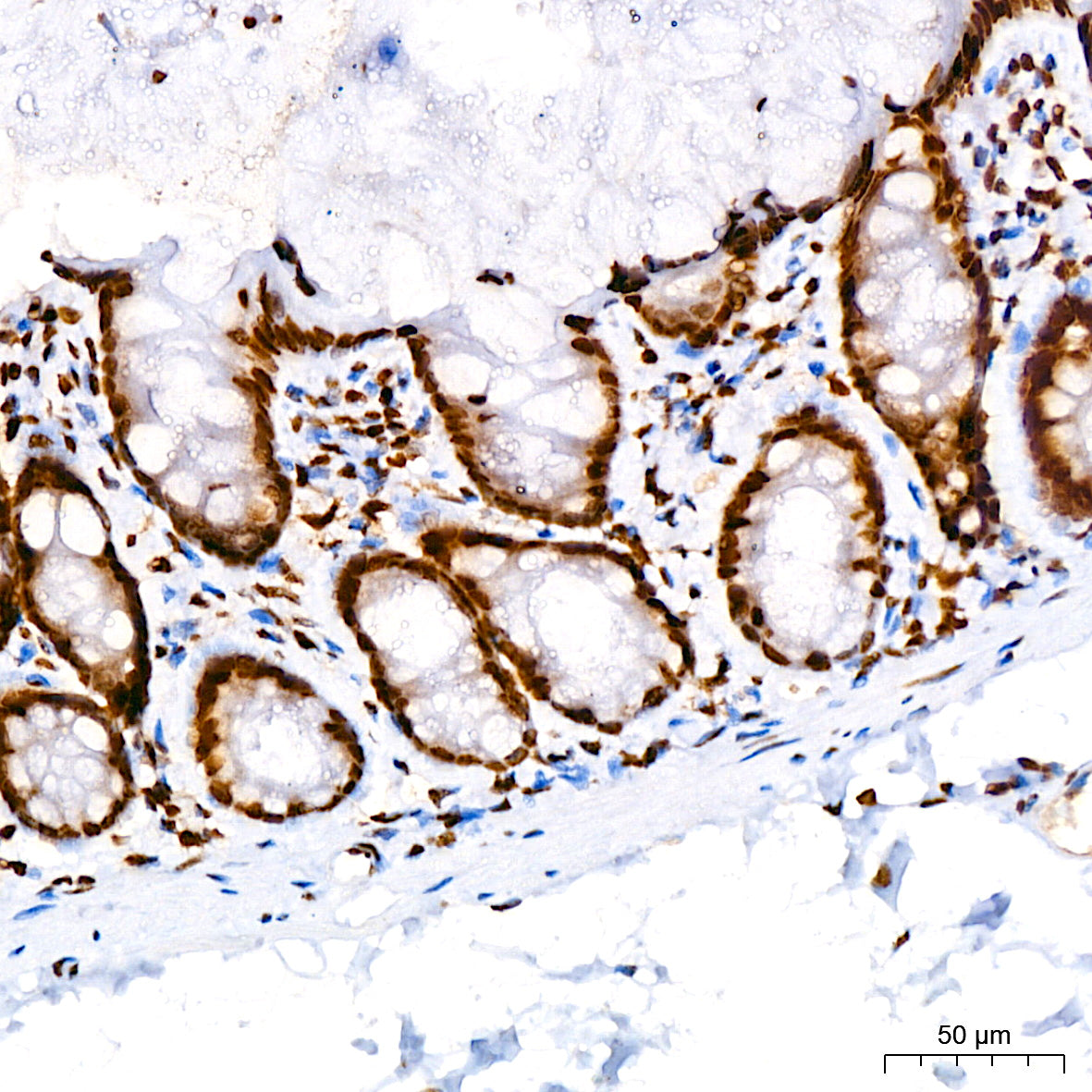 Acetyl-Histone H3-K4 Rabbit mAb