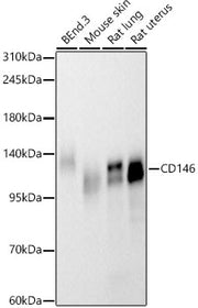 CD146 Rabbit mAb