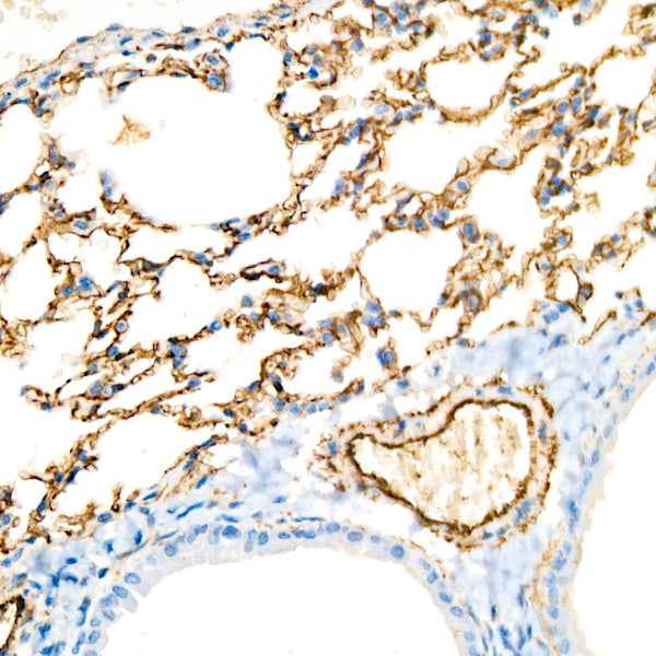 CD146 Rabbit mAb