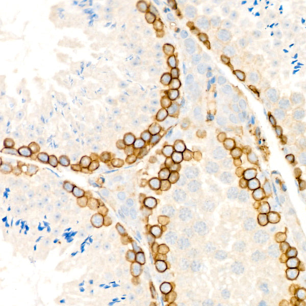 CD146 Rabbit mAb
