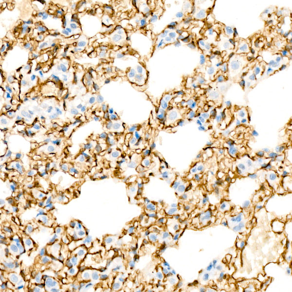 CD146 Rabbit mAb