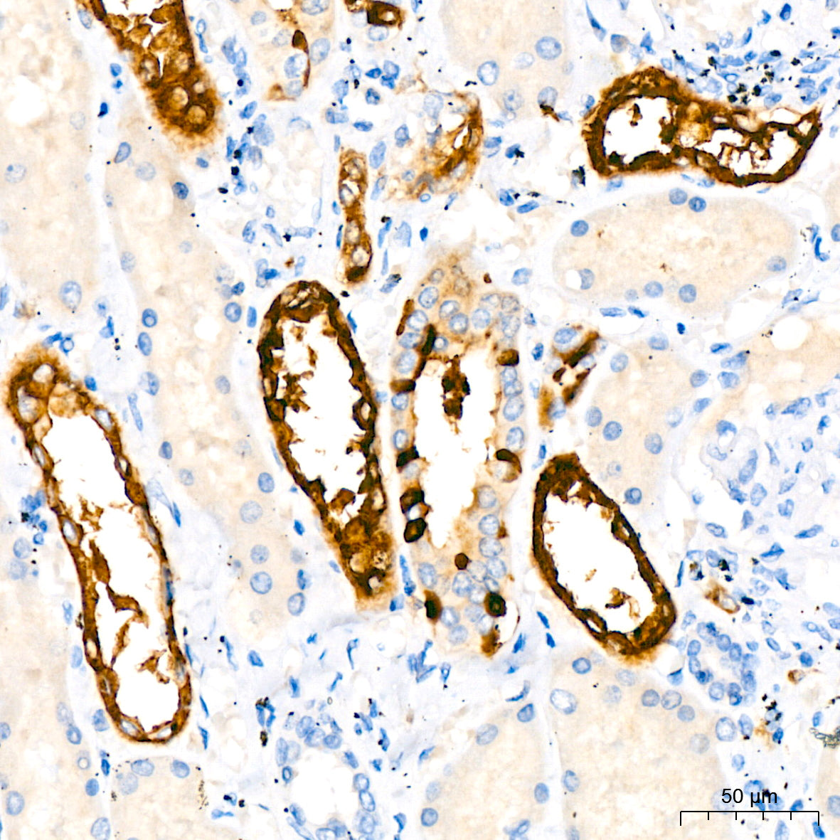 Flt3/CD135 Rabbit mAb