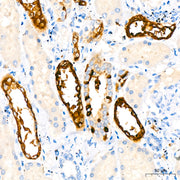 Flt3/CD135 Rabbit mAb