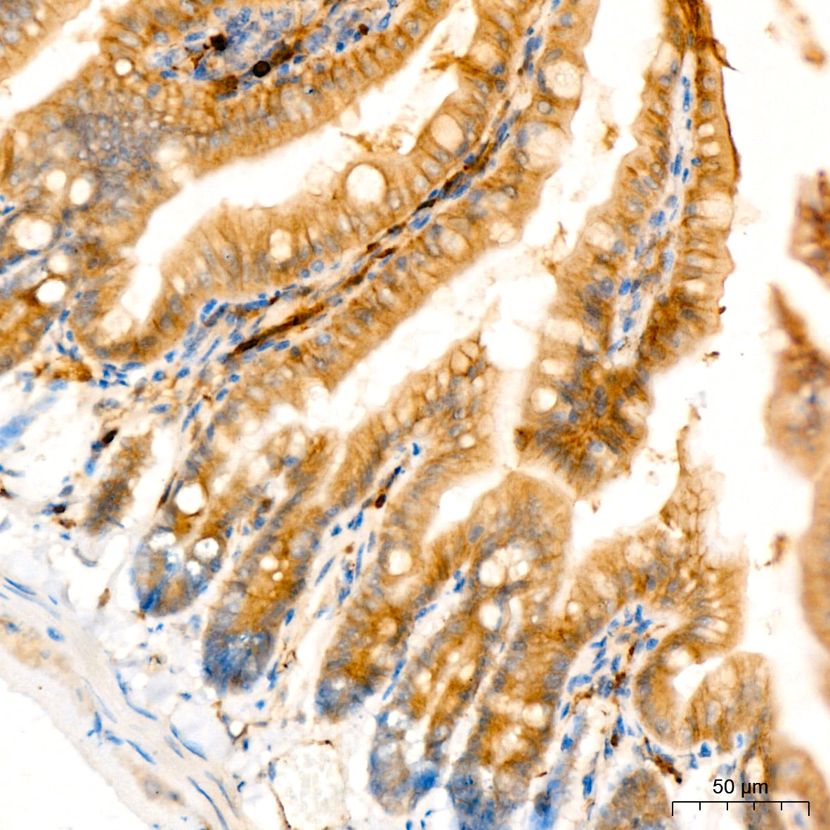 Flt3/CD135 Rabbit mAb