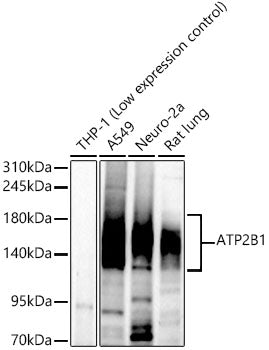 ATP2B1 Rabbit mAb