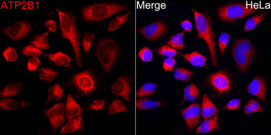 ATP2B1 Rabbit mAb