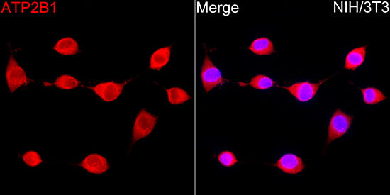 ATP2B1 Rabbit mAb