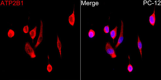 ATP2B1 Rabbit mAb
