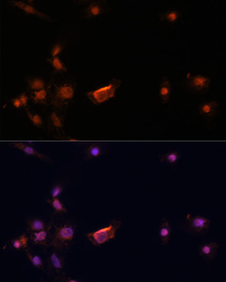 BRCA2 Rabbit pAb