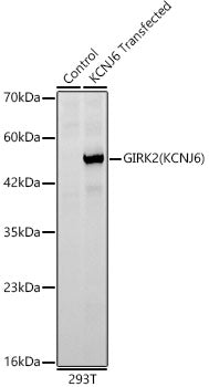 GIRK2(KCNJ6) Rabbit mAb