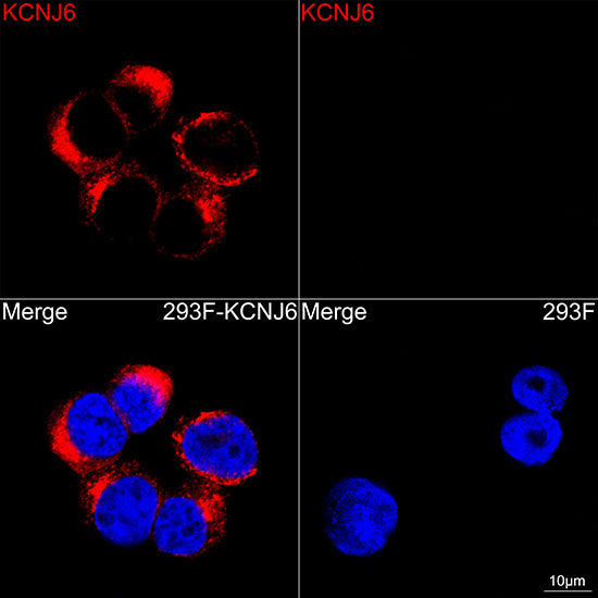 GIRK2(KCNJ6) Rabbit mAb