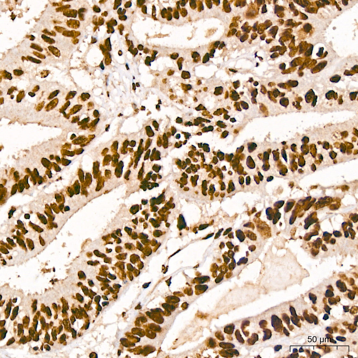 HMGA2 Rabbit mAb