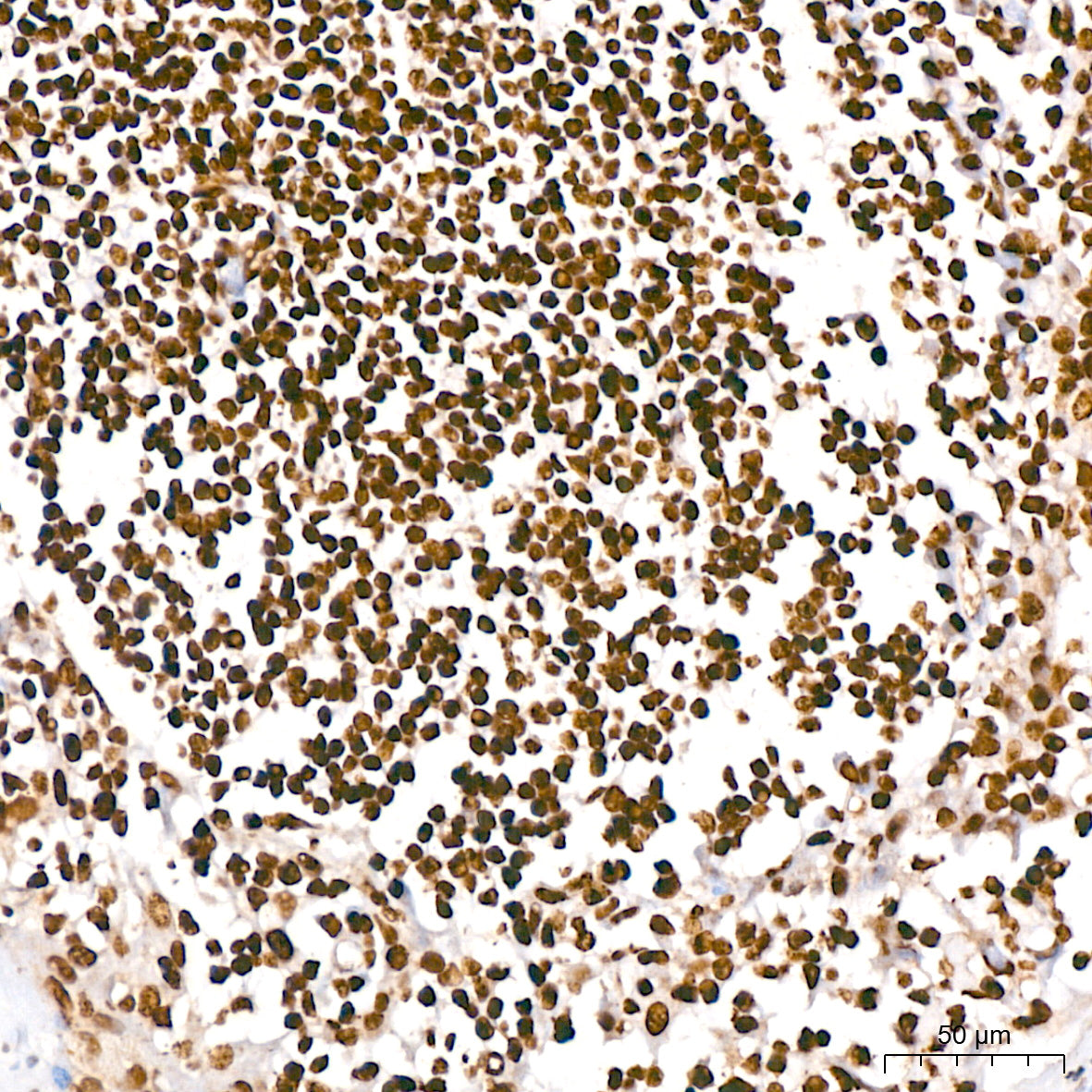 HMGA2 Rabbit mAb