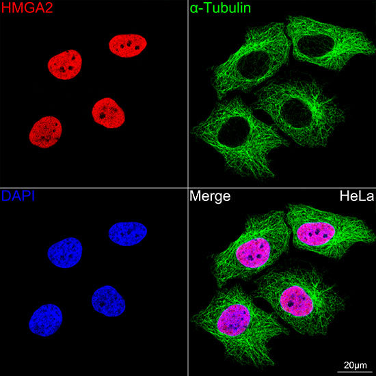 HMGA2 Rabbit mAb