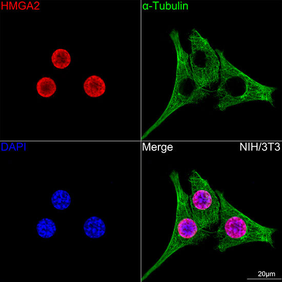 HMGA2 Rabbit mAb