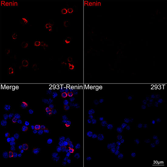 Renin Rabbit mAb