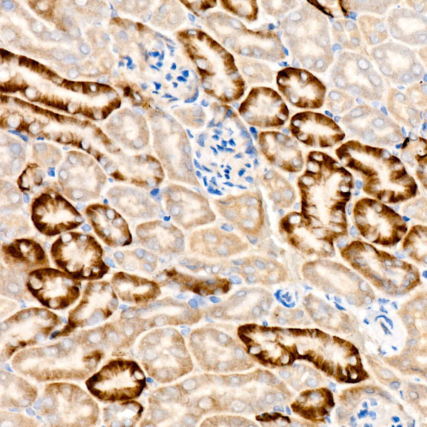 MEK1/MEK2 Rabbit mAb