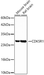 CDK5R1 Rabbit mAb