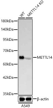 [KD Validated] METTL14 Rabbit mAb