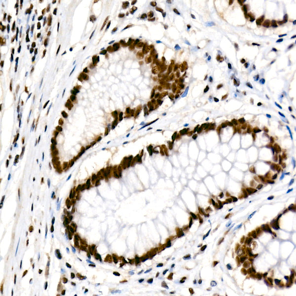 [KD Validated] METTL14 Rabbit mAb
