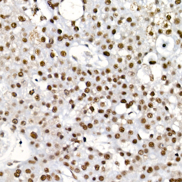 [KD Validated] METTL14 Rabbit mAb