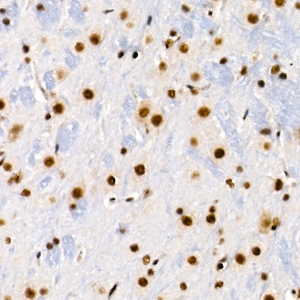 [KD Validated] METTL14 Rabbit mAb