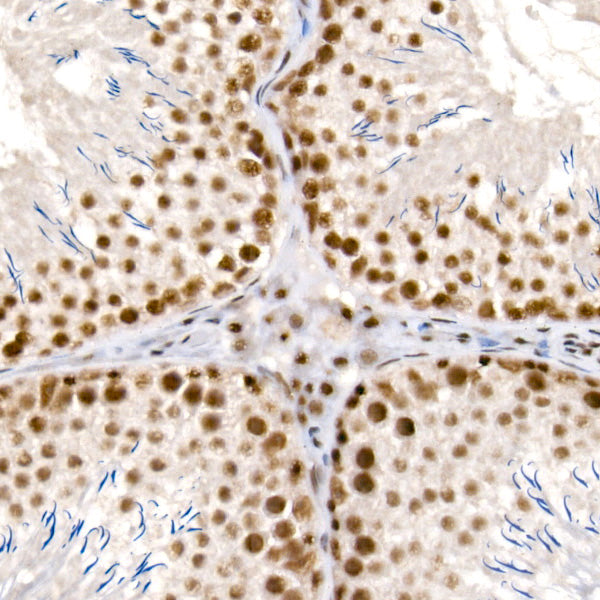 [KD Validated] METTL14 Rabbit mAb