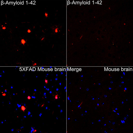 β-Amyloid(1-42) Rabbit mAb