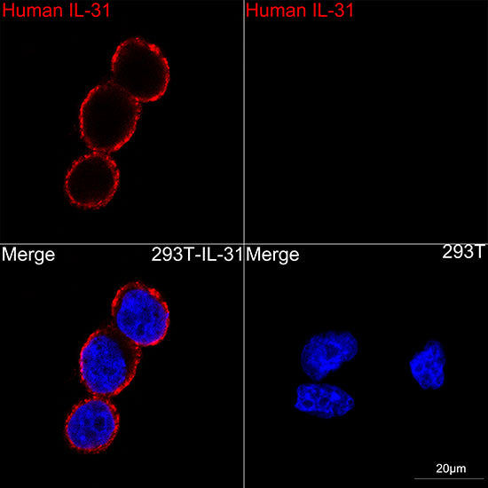 IL-31 Rabbit mAb