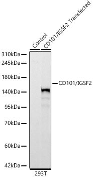 CD101/IGSF2 Rabbit mAb