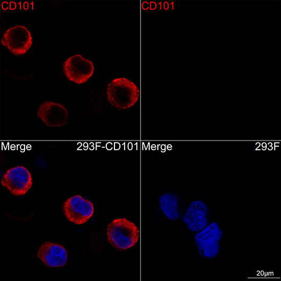 CD101/IGSF2 Rabbit mAb