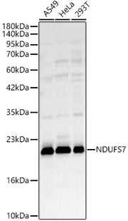 NDUFS7 Rabbit pAb