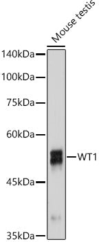 WT1 Rabbit mAb