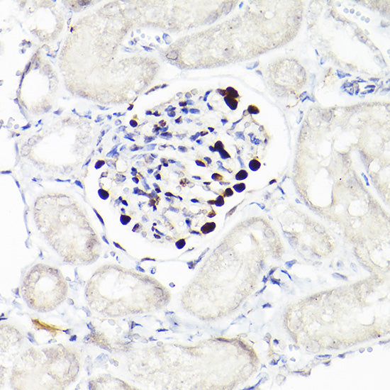 WT1 Rabbit mAb