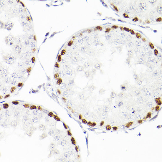 WT1 Rabbit mAb