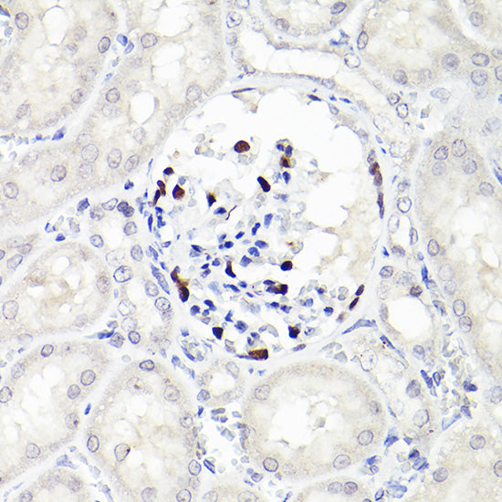 WT1 Rabbit mAb