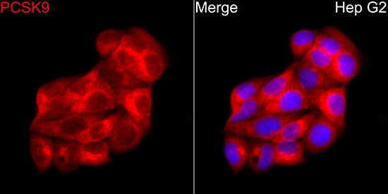 PCSK9 Rabbit pAb