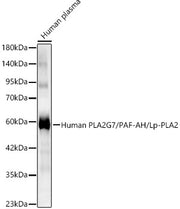 Human PLA2G7/PAF-AH/Lp-PLA2 Rabbit pAb