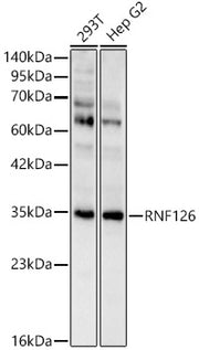 RNF126 Rabbit pAb