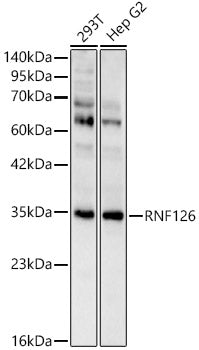 RNF126 Rabbit pAb